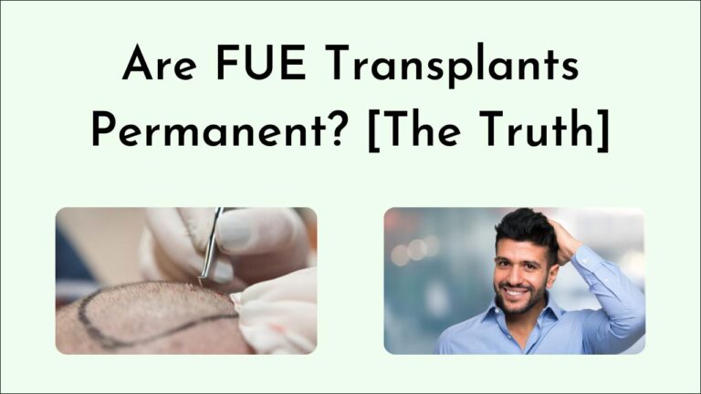 Are FUE Transplants Permanent? [The Truth]