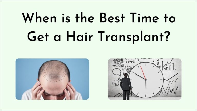 When is the Best Time to Get Hair Transplant? 5 Factors That Determine Your Best Options