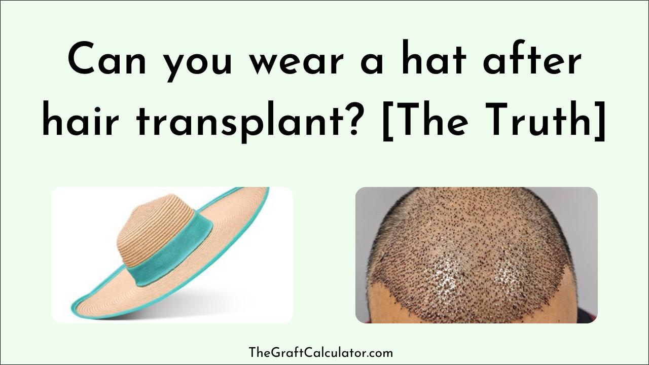 Can you wear a hat after hair transplant? [The Truth] - The Graft Calculator