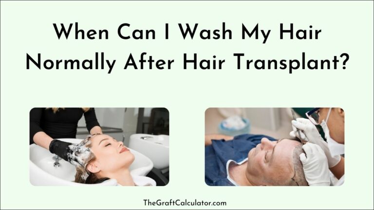 When Can I Wash My Hair Normally After Hair Transplant? [Details]