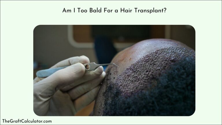 Am I Too Bald For a Hair Transplant?