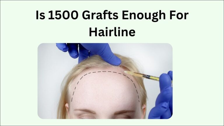 Is 1500 Grafts Enough For Hairline?