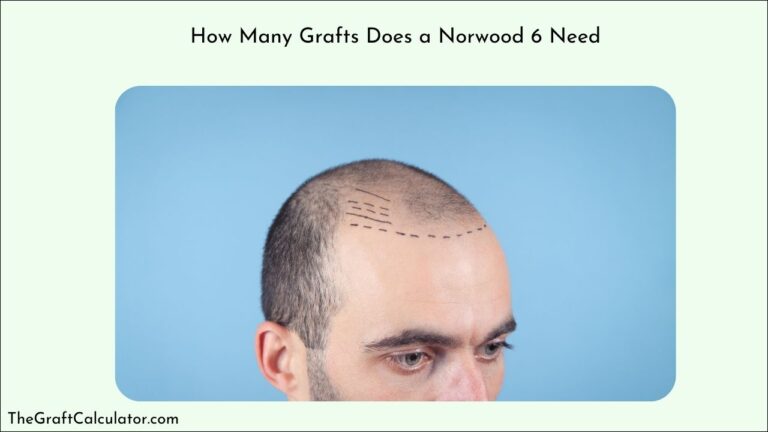 How Many Grafts Does a Norwood 6 Need?